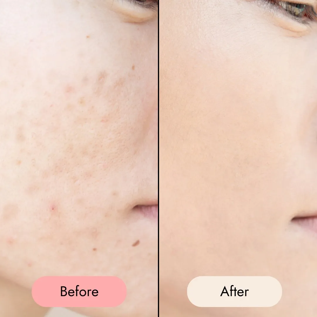 Cleansing Foam
